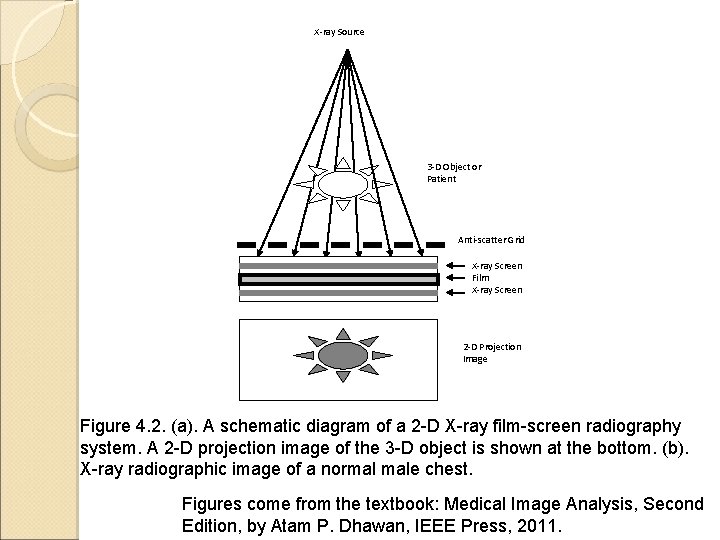 X-ray Source 3 -D Object or Patient Anti-scatter Grid X-ray Screen Film X-ray Screen