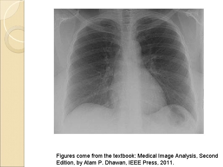 Figures come from the textbook: Medical Image Analysis, Second Edition, by Atam P. Dhawan,