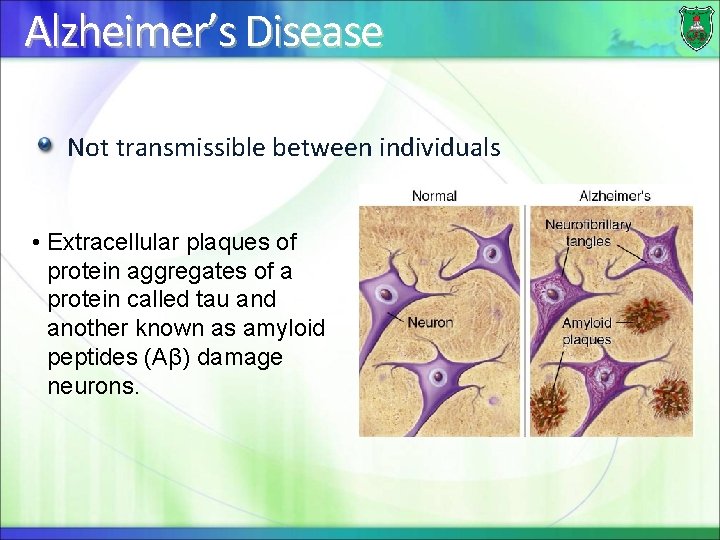 Alzheimer’s Disease Not transmissible between individuals • Extracellular plaques of protein aggregates of a