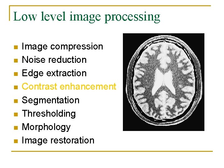 Low level image processing n n n n Image compression Noise reduction Edge extraction