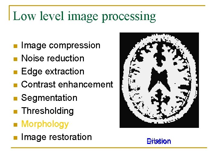 Low level image processing n n n n Image compression Noise reduction Edge extraction