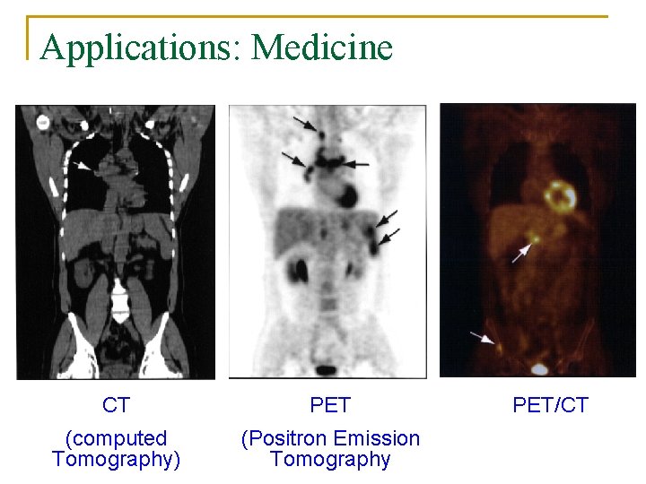 Applications: Medicine CT PET (computed Tomography) (Positron Emission Tomography PET/CT 