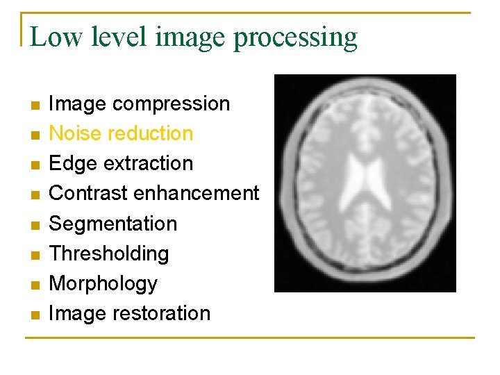 Low level image processing n n n n Image compression Noise reduction Edge extraction