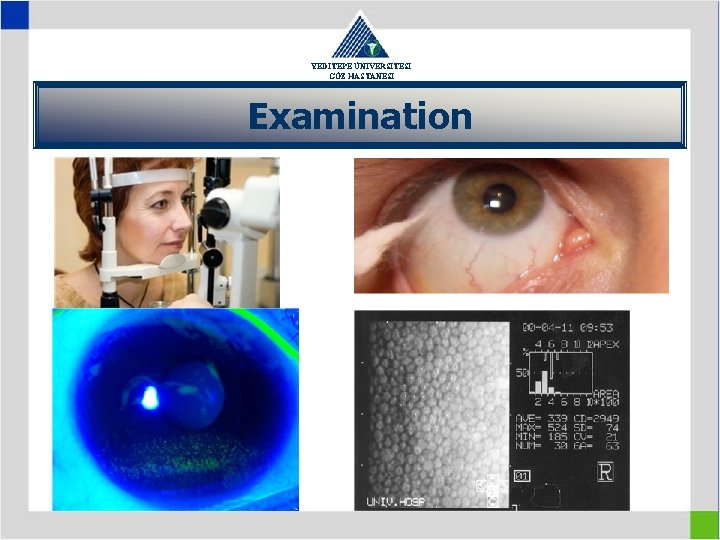 YEDİTEPE ÜNİVERSİTESİ GÖZ HASTANESİ Examination 