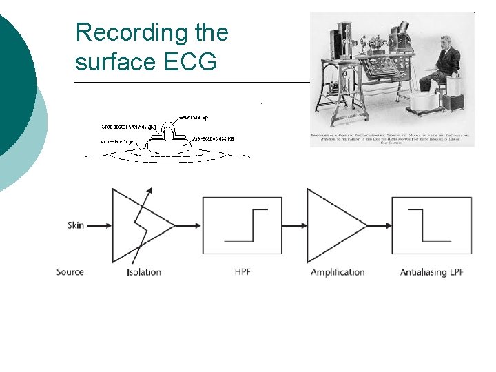 Recording the surface ECG 