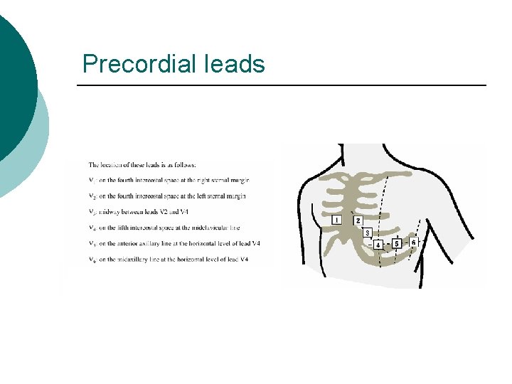 Precordial leads 