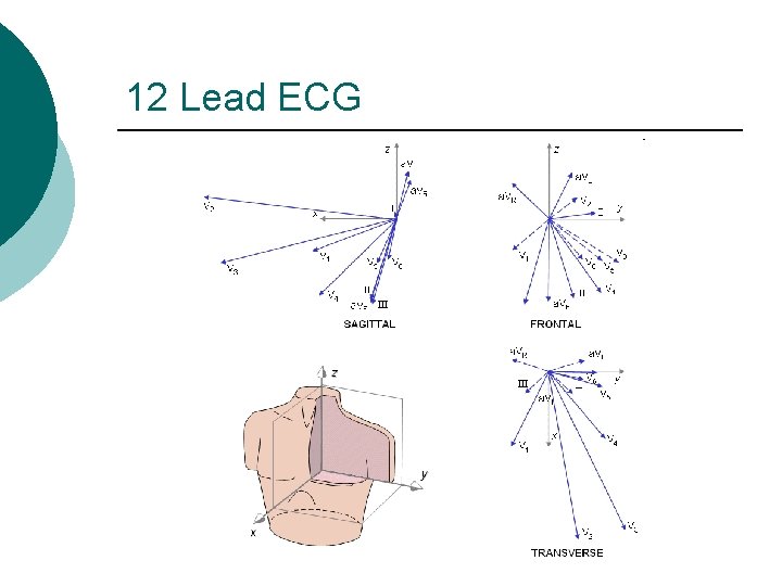 12 Lead ECG 