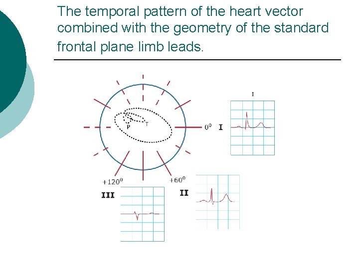 The temporal pattern of the heart vector combined with the geometry of the standard