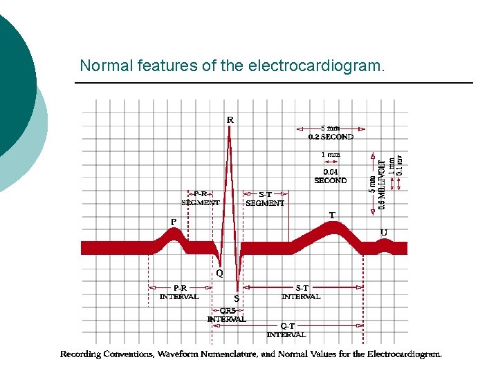 Normal features of the electrocardiogram. 