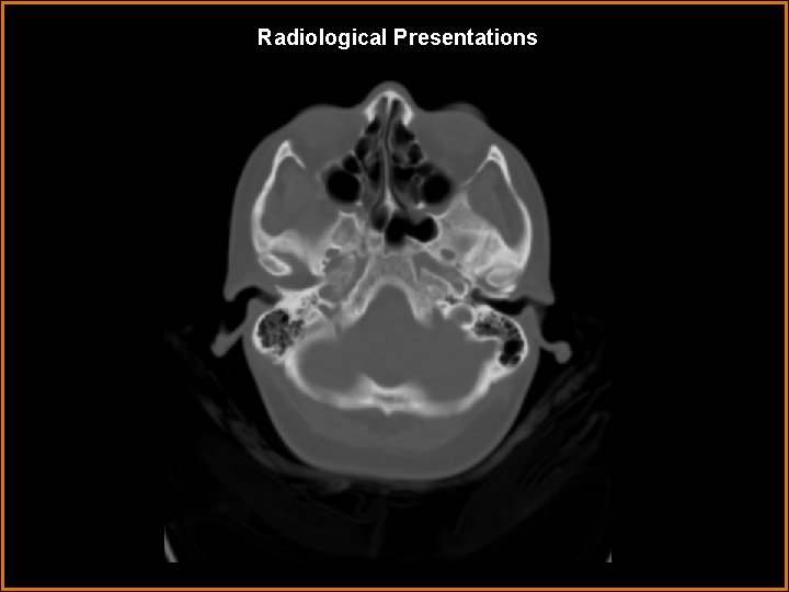 Radiological Presentations 