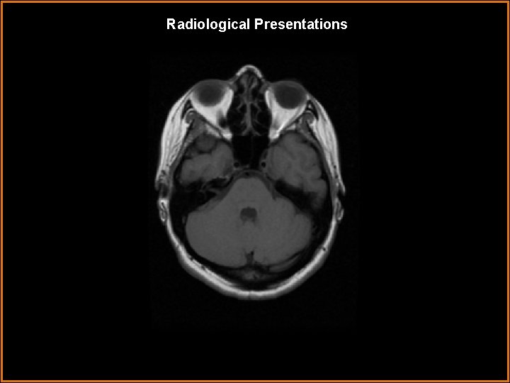 Radiological Presentations 