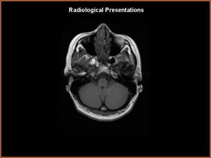 Radiological Presentations 