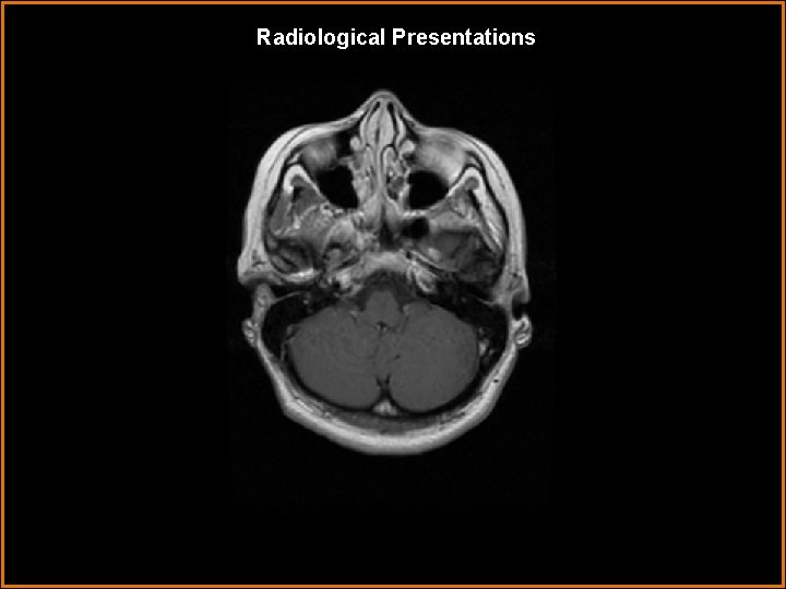 Radiological Presentations 