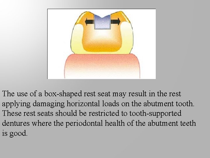 The use of a box-shaped rest seat may result in the rest applying damaging