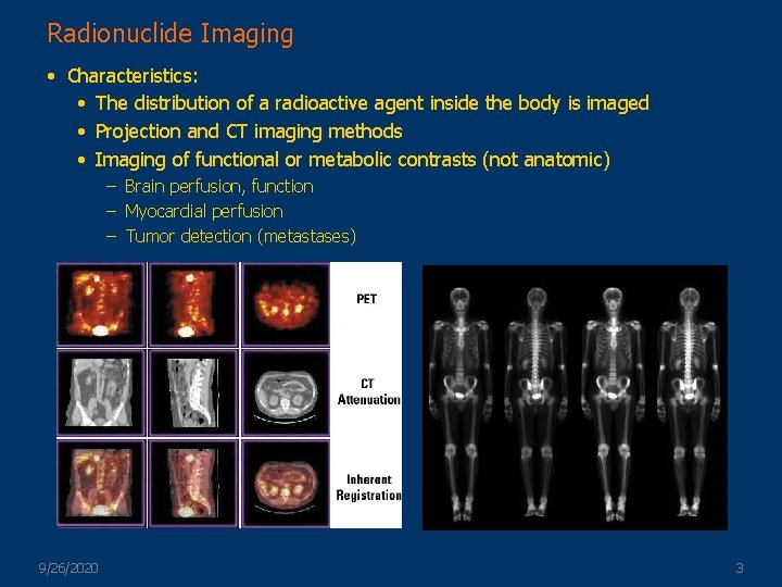 Radionuclide Imaging • Characteristics: • The distribution of a radioactive agent inside the body