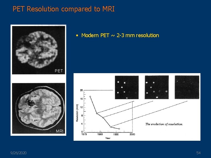 PET Resolution compared to MRI • Modern PET ~ 2 -3 mm resolution PET