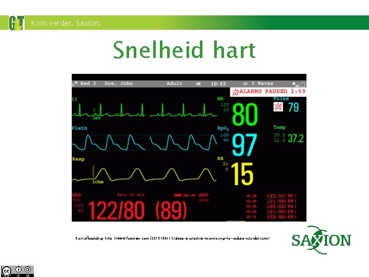 Kom verder. Saxion. Snelheid hart Bron afbeelding: http: //www. foamem. com/2015/04/13/sleep-protective-monitoring-to-reduce-icu-delirium/ 