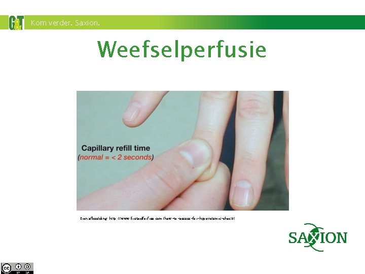 Kom verder. Saxion. Weefselperfusie Bron afbeelding: http: //www. firstaidforfree. com/how-to-assess-for-hypovolemic-shock/ 