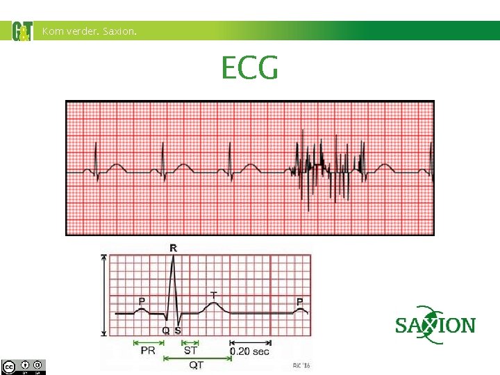 Kom verder. Saxion. ECG 