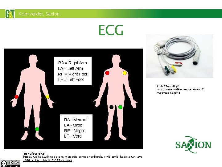 Kom verder. Saxion. ECG Bron afbeelding: http: //www. online. megos. eu/co/7 -ecg-cables? p=3 Bron