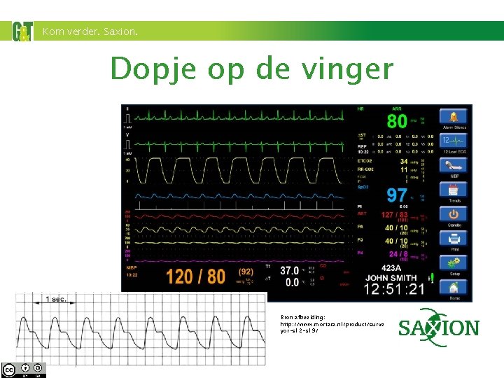 Kom verder. Saxion. Dopje op de vinger Bron afbeelding: http: //www. mortara. nl/product/surve yor-s