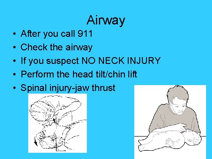 Airway • • • After you call 911 Check the airway If you suspect