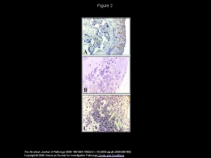 Figure 2 The American Journal of Pathology 2006 1691294 -1302 DOI: (10. 2353/ajpath. 2006.