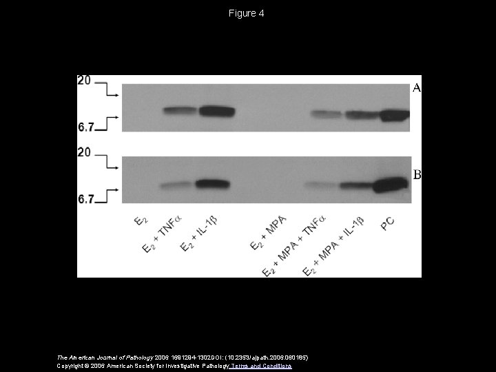 Figure 4 The American Journal of Pathology 2006 1691294 -1302 DOI: (10. 2353/ajpath. 2006.