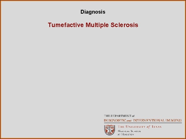 Diagnosis Tumefactive Multiple Sclerosis 