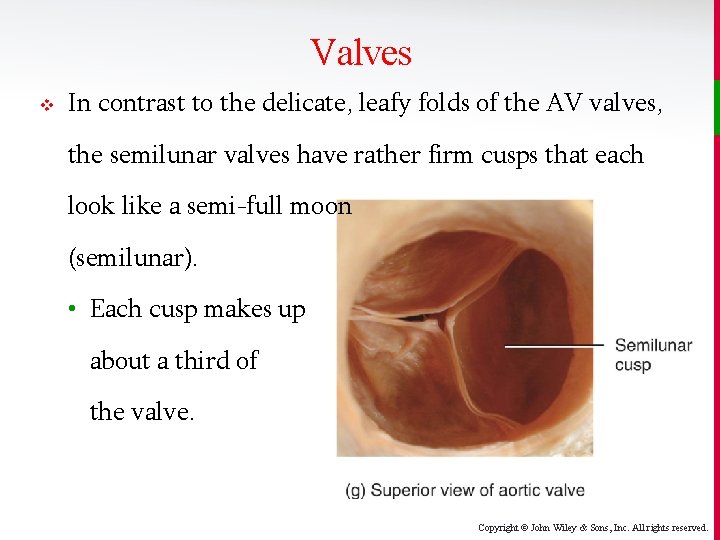 Valves v In contrast to the delicate, leafy folds of the AV valves, the