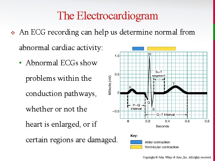 The Electrocardiogram v An ECG recording can help us determine normal from abnormal cardiac