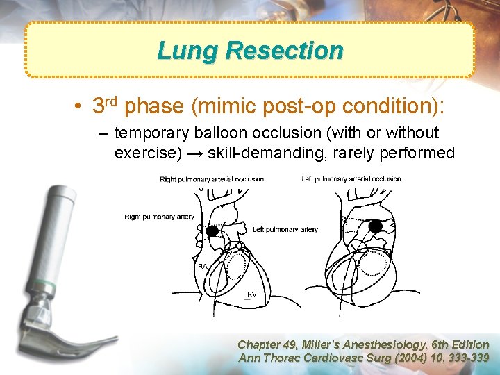 Lung Resection • 3 rd phase (mimic post-op condition): – temporary balloon occlusion (with
