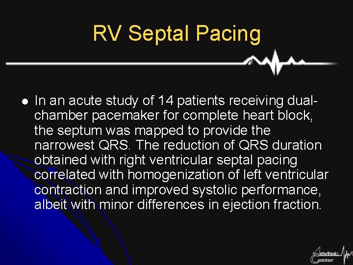 RV Septal Pacing l In an acute study of 14 patients receiving dualchamber pacemaker