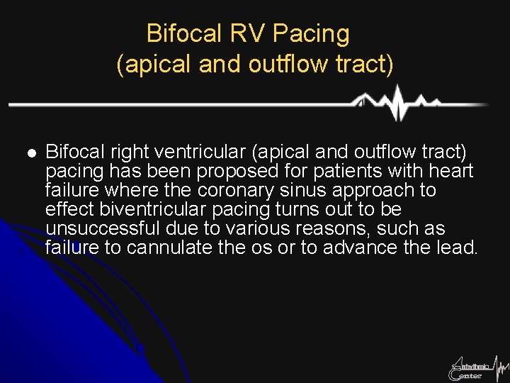 Bifocal RV Pacing (apical and outflow tract) l Bifocal right ventricular (apical and outflow