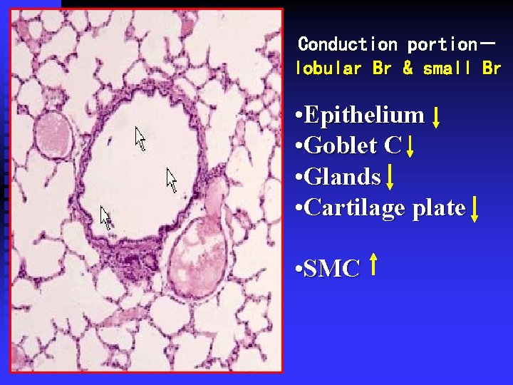 Conduction portion－ lobular Br & small Br • Epithelium • Goblet C • Glands