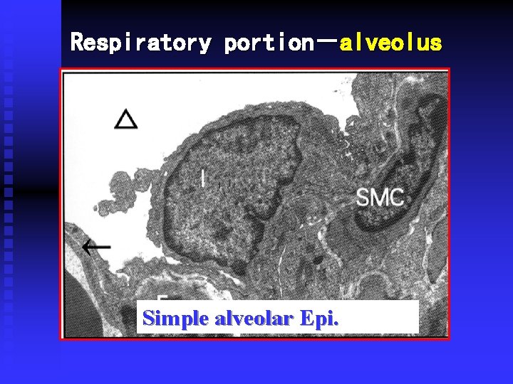 Respiratory portion－alveolus 肺泡管 Simple alveolar Epi. 