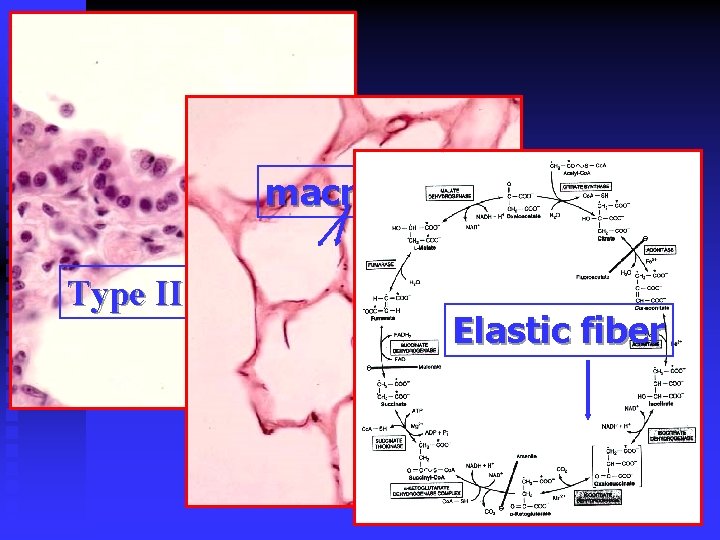 macrophage Type II alveolar C Elastic fiber 
