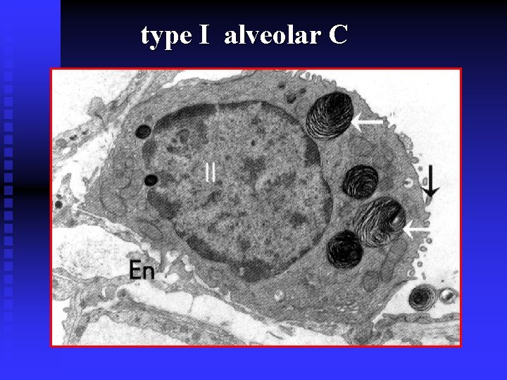 type I alveolar C 