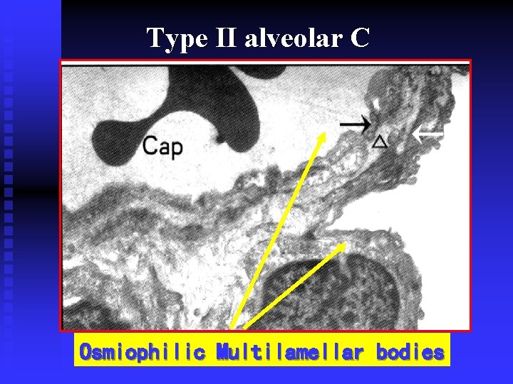 Type II alveolar C Osmiophilic Multilamellar bodies 