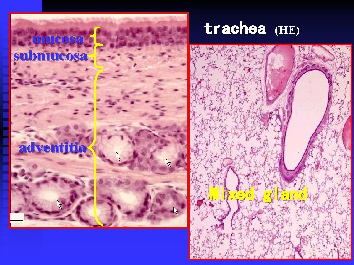 mucosa submucosa trachea (HE) adventitia Mixed gland 