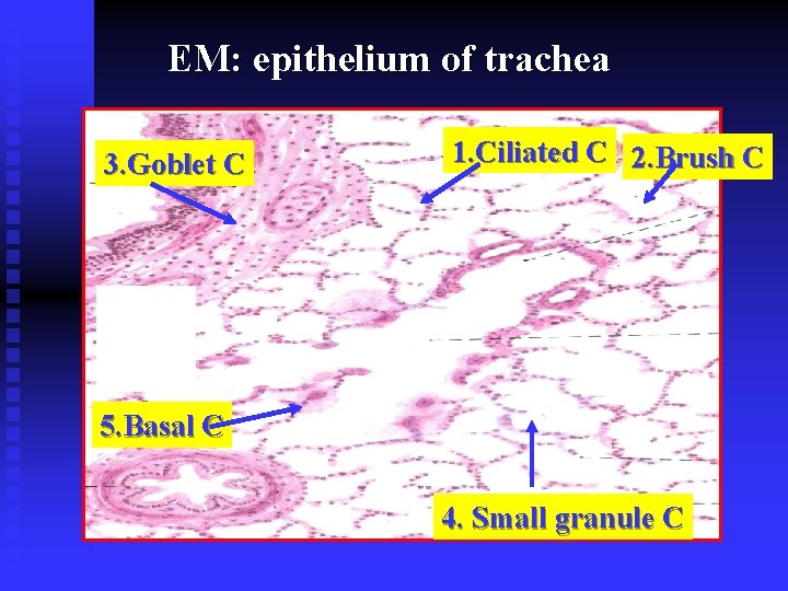 EM: epithelium of trachea 3. Goblet C 1. Ciliated C 2. Brush C 5.