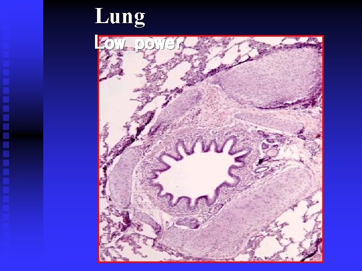 L ung Low power L ung Low power