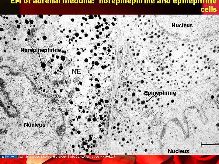 EM of adrenal medulla: norepinephrine and epinephrine cells Nucleus Norepinephrine Epinephrine Nucleus Stan Erlandsen