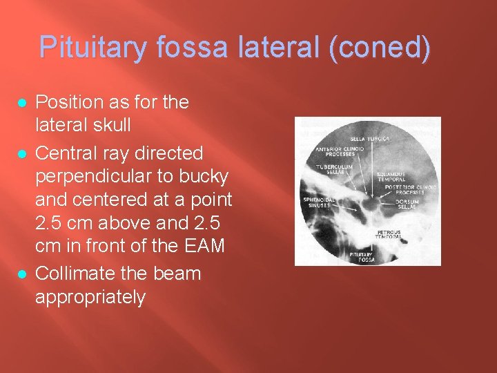 Pituitary fossa lateral (coned) l l l Position as for the lateral skull Central
