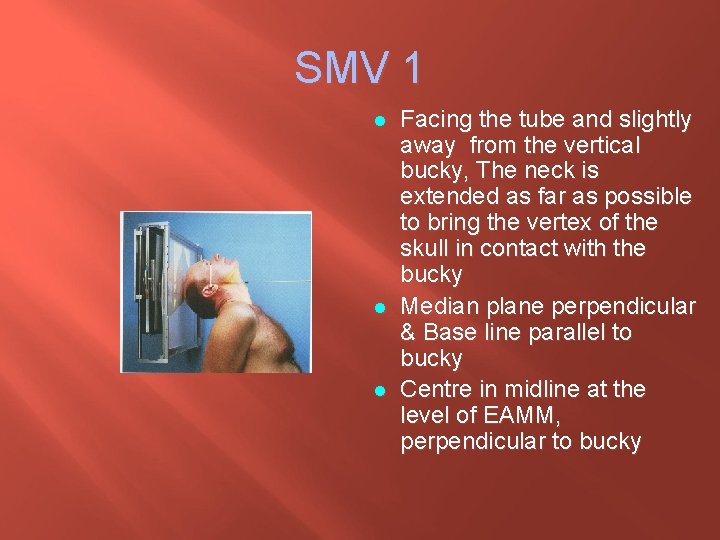 SMV 1 l l l Facing the tube and slightly away from the vertical