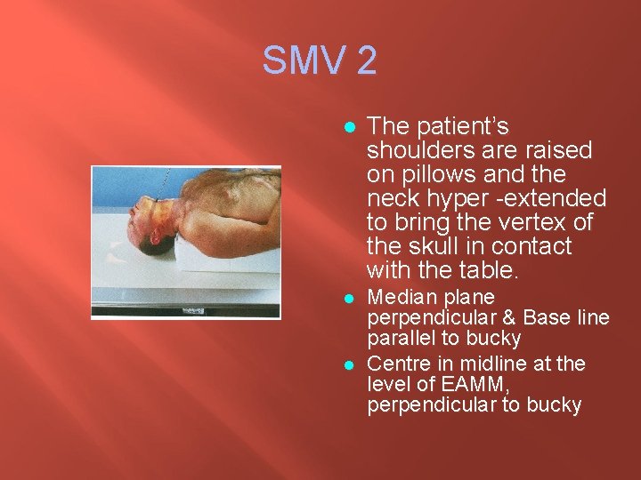 SMV 2 l The patient’s shoulders are raised on pillows and the neck hyper