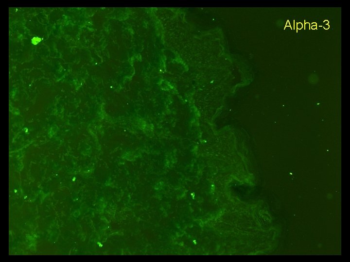 Alpha-3 Alpha-3