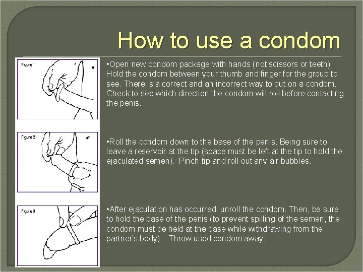 How to use a condom • Open new condom package with hands (not scissors