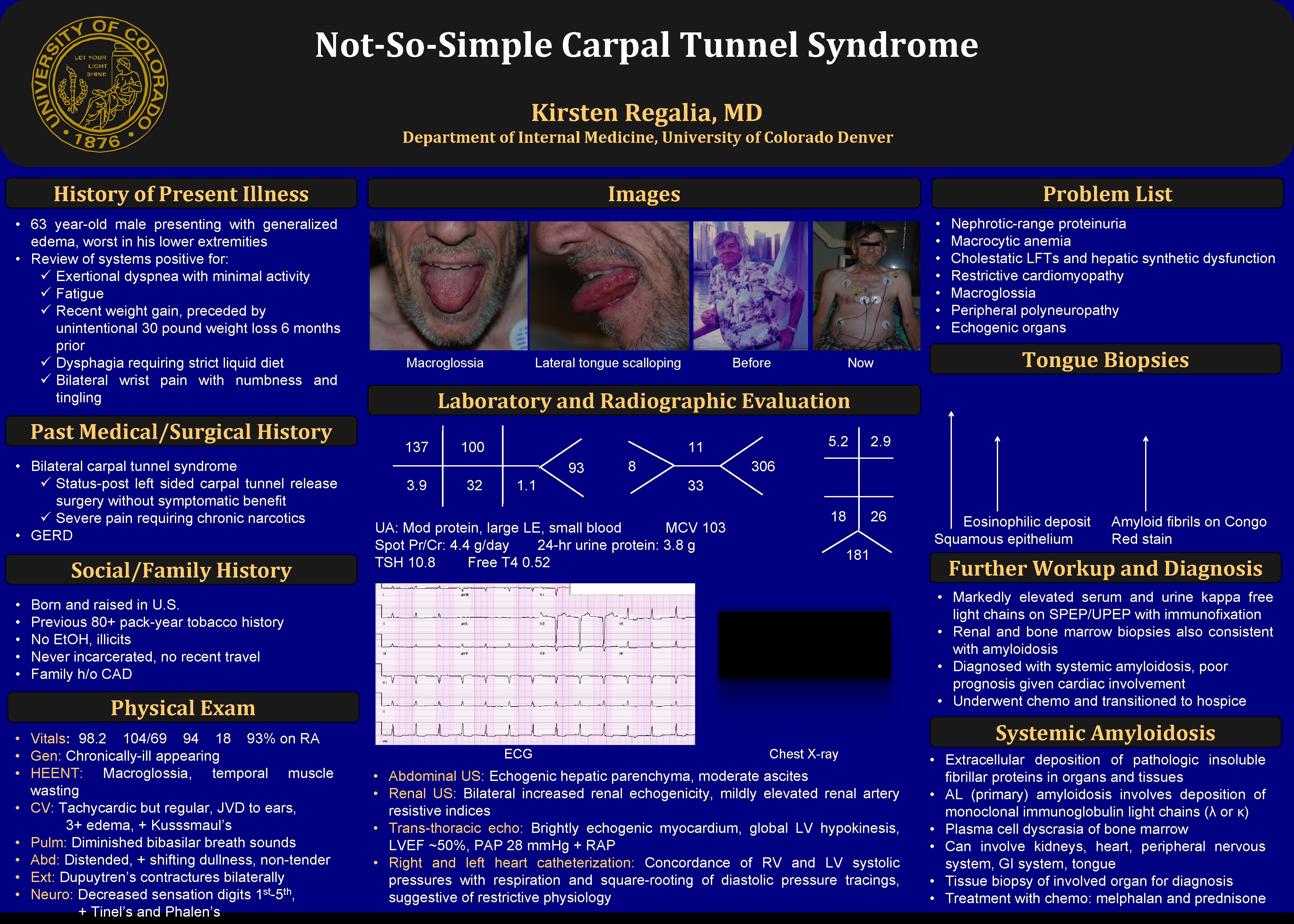 Not-So-Simple Carpal Tunnel Syndrome Kirsten Regalia, MD Department of Internal Medicine, University of Colorado