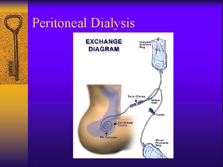 Peritoneal Dialysis . 